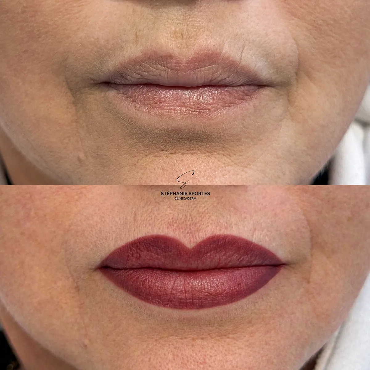 Dermopigmentation correctrice des lèvres, correction et restauration du contour