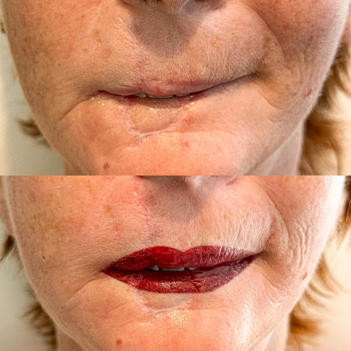 Dermopigmentation réparatrice du visage après reconstruction faciale