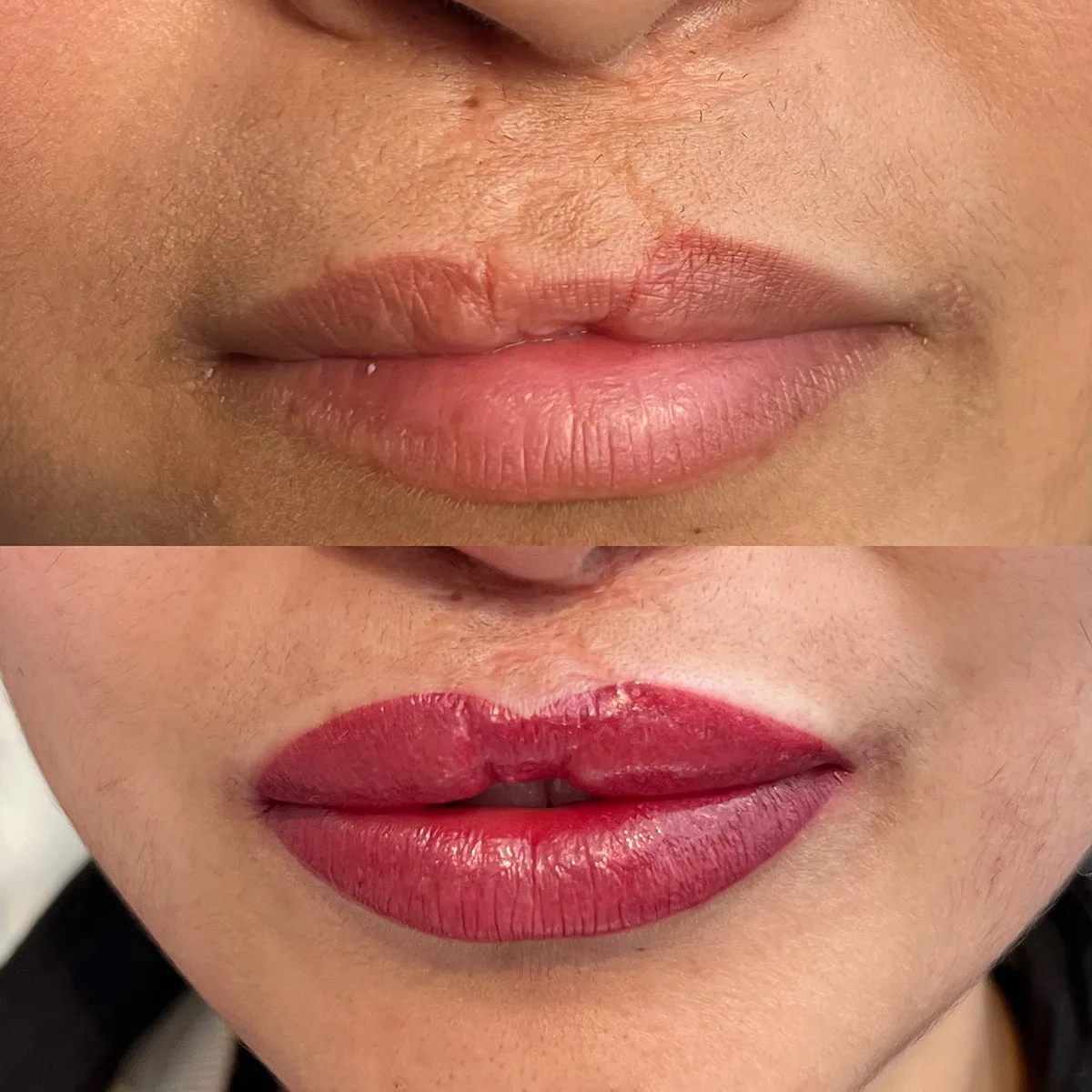 Malformations et reconstructions du visage, résultat 2