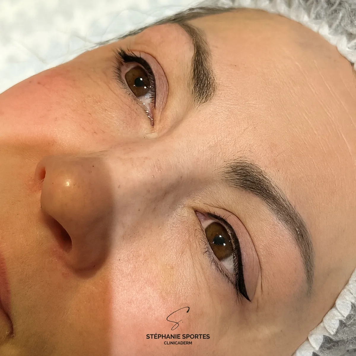Liner, résultat 1