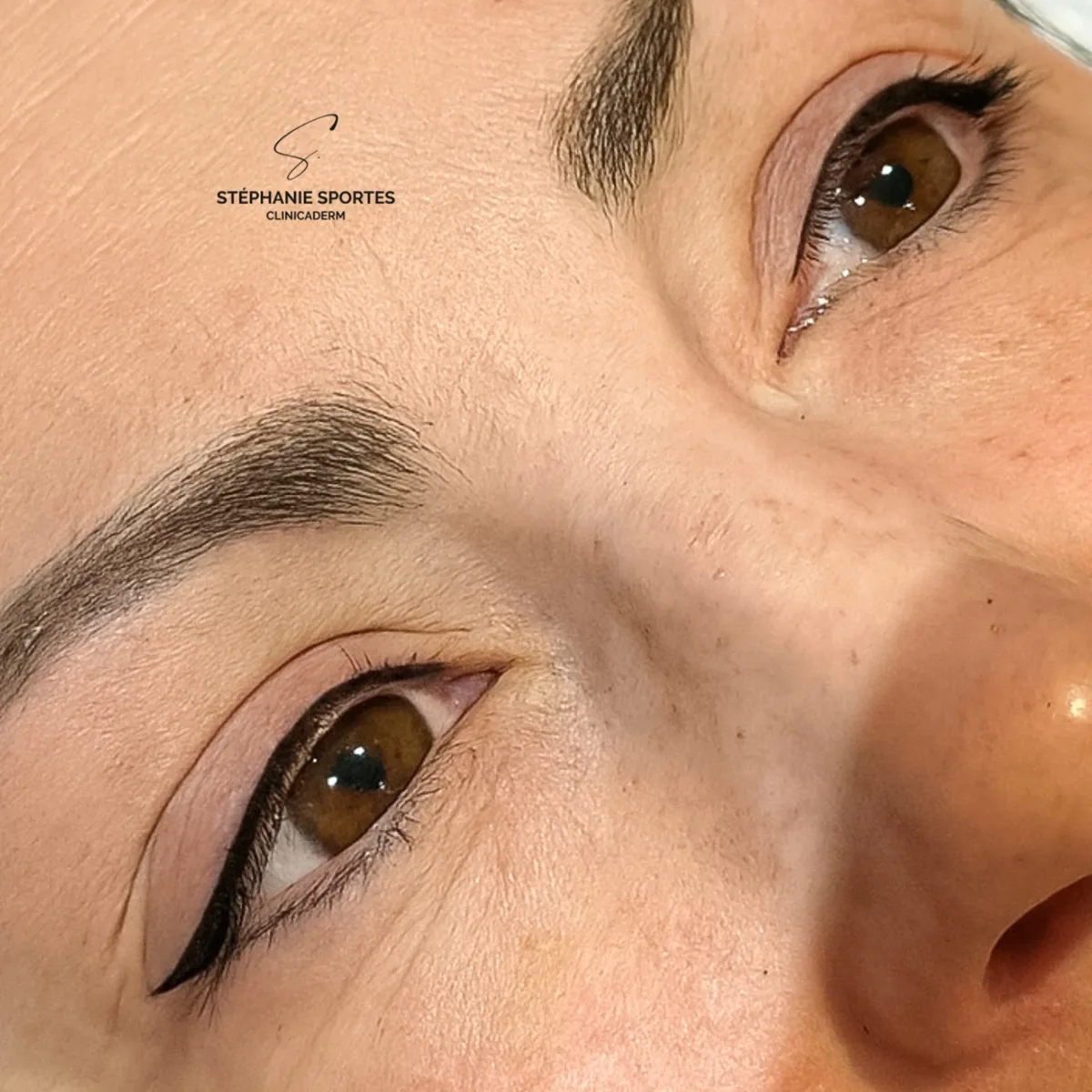 Liner réalisé par dermopigmentation correctrice du regard