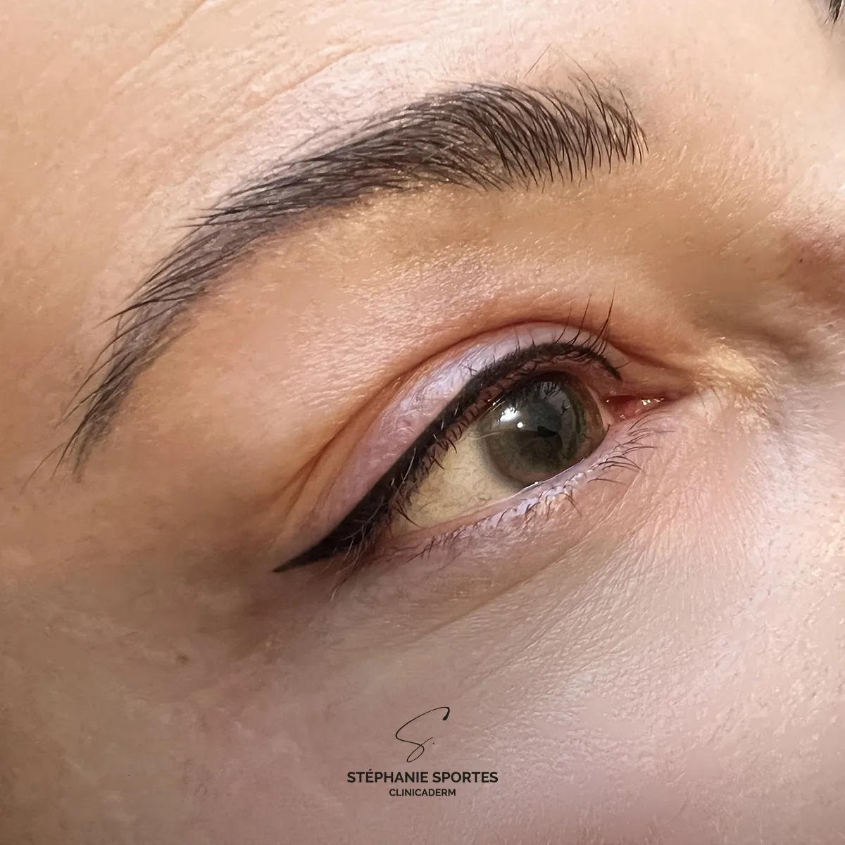 Liner, résultat 2