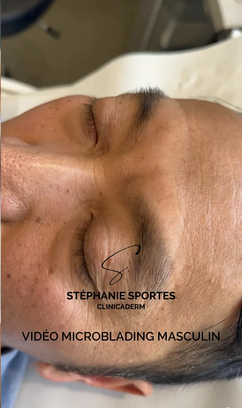 Vidéo : microblading masculin